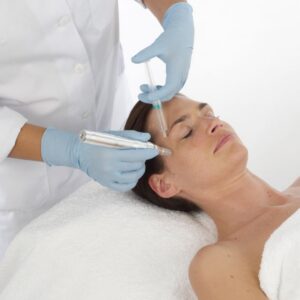 Microneedling