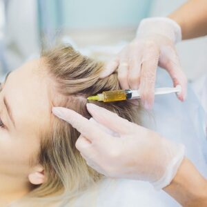 Mesoterapia Capilar