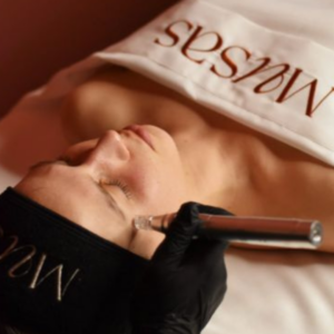 MICRONEEDLING SMART DNA RETIX + RADIESSE