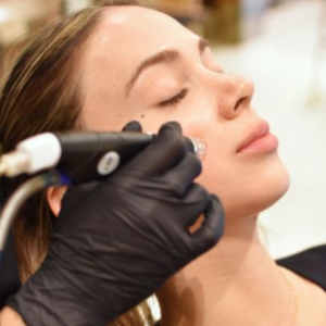 HYDRAFACIAL + HIDRATACIÓN DE LABIOS