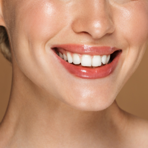 Sonrisa gingival